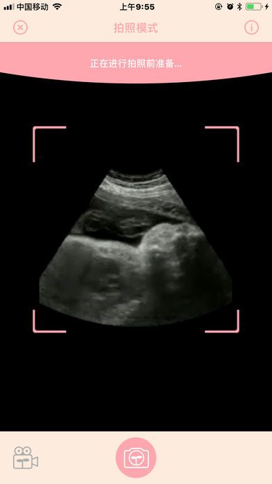 胎儿相机截图2