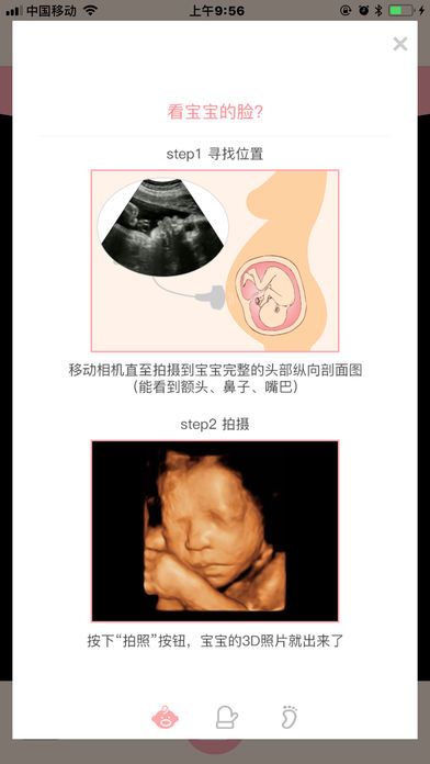 胎儿相机iOS版截图3