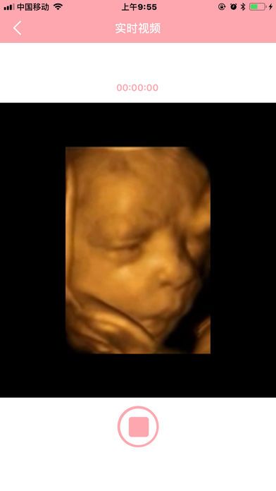 胎儿相机截图4