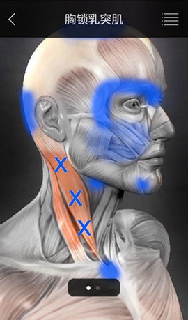 肌肉学图谱(MuscleTriggerPoints)
