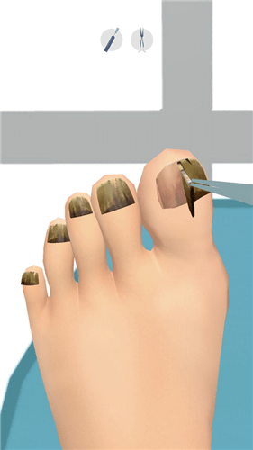 Foots Clinic游戏截图2