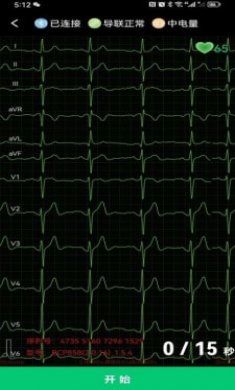 心电一张网截图3